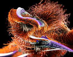 Непроникающая глубокая склерэктомия